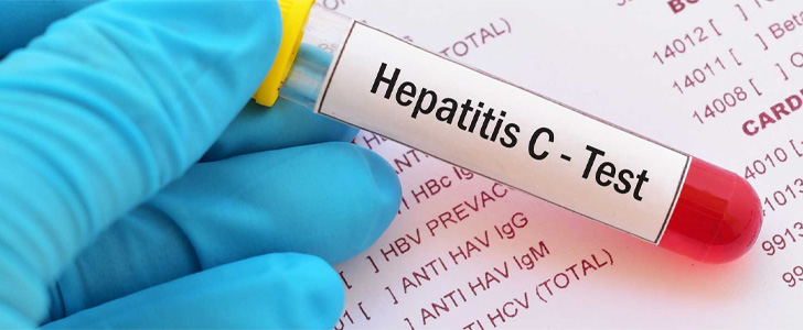 Close up of Hepatitis-C test